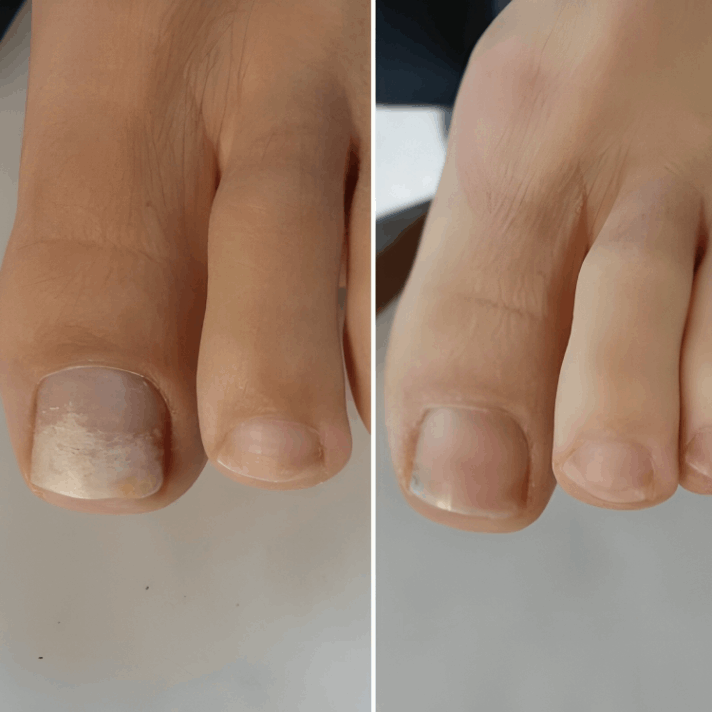 Welnax BioClear customer review J. Cole